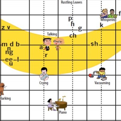 audiogram